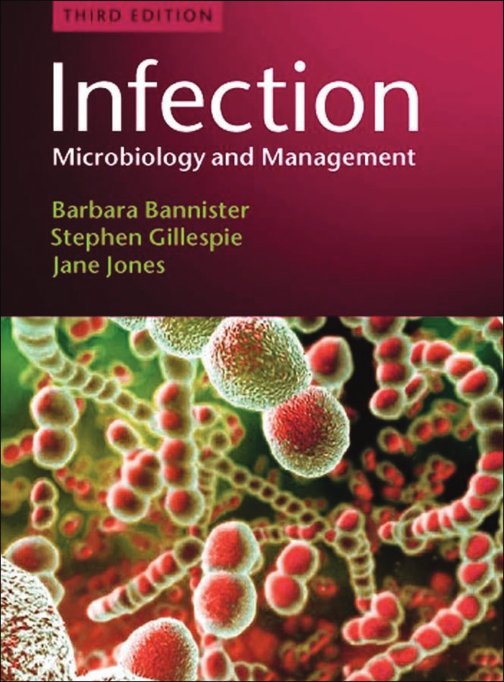 Infection - Microbiology and Management